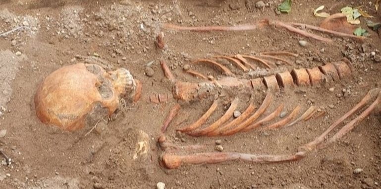 human remains